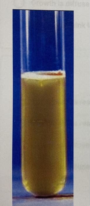 Solved Glucose Lactose Phenol Red Broth Result Both Chegg