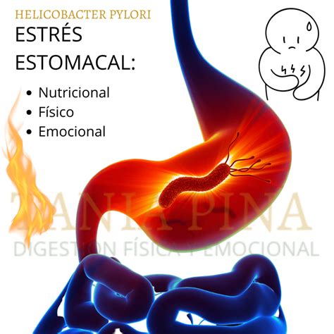 Helicobacter Pylori Tratamiento Natural Con El M Todo Ama Tania Pina