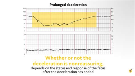 Fetal Heart Rate Patient Care Review Video