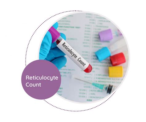 Reticulocyte Count MediScan Lab