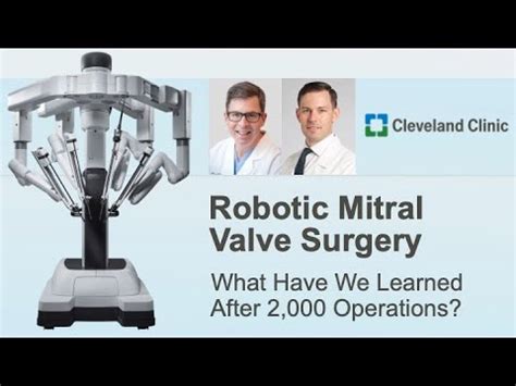 Robotic Mitral Valve Repair What Have We Learned After