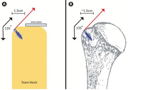 A Illustration Of Our Model For Simulating The Proximal Humerus Download Scientific Diagram