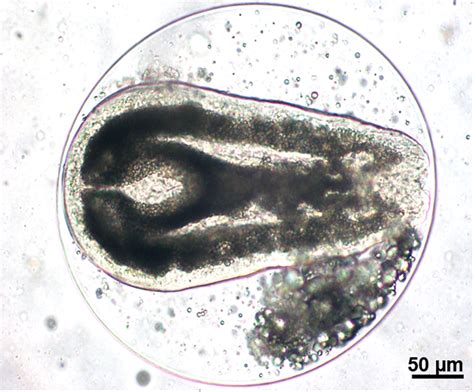 Digenean Holostephanus Trematoda Digenea Cyathocotylidae