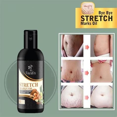 Focufix Present Repair Stretch Marks Removal Natural Heal Pregnancy