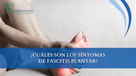 Cu Les Son Los S Ntomas De Fascitis Plantar Dr Mariano De Jes S