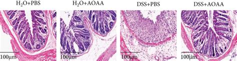 AOAA Alleviated DSS Induced Colitis In Mice And Restored MRNA