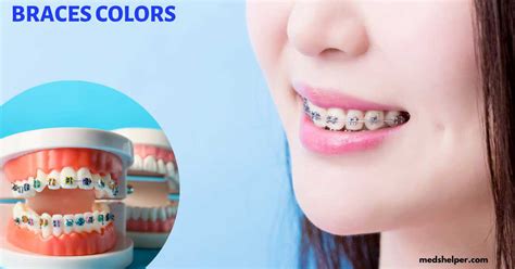 What Are The Best Braces Colors Braces Color Wheel