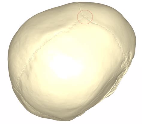 bregma ars neurochirurgica