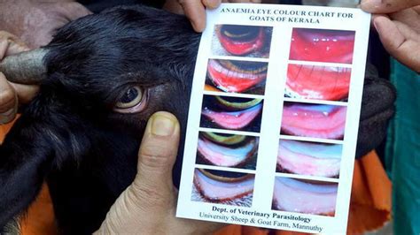 This Eye Card Developed By A Kerala Professor Detects Worm Infection In