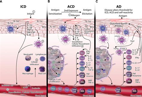 Atopic Dermatitis Results In Intrinsic Barrier And Immune Abnormalities