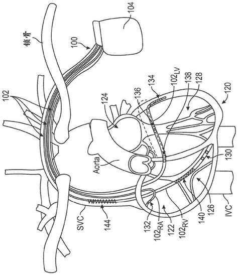 Ecg