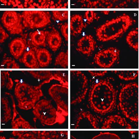 Immunofluorescence Localization Of HnRNP K In Porcine Developmental