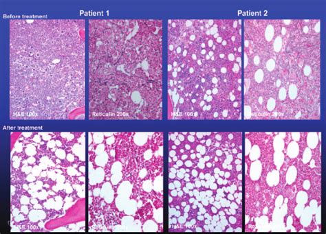 Bone Staining Histology