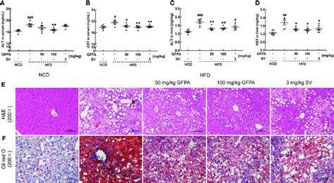 Gfpa Alleviated Hepatic Steatosis In Mice With Dio In Hfd Fed Mice