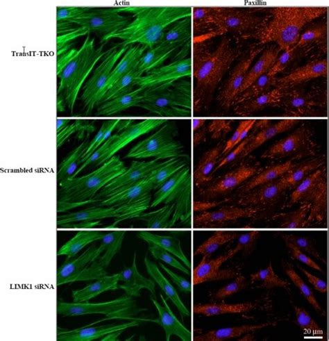 Downregulation Of LIMK1 Decreases Actin Polymerization And Focal