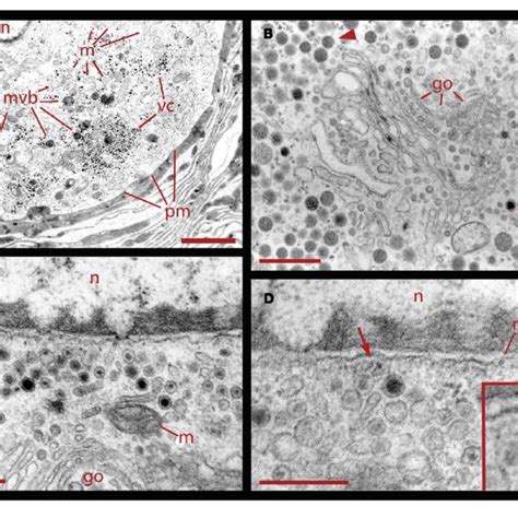 Perinuclear Multivesicular Bodies A Multivesicular Bodies Mvb