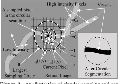 Figure 1 From A Simple Hybrid Method For Segmenting Vessel Structures