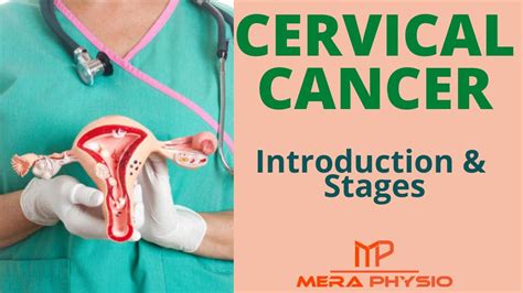 Cervical Cancer Introduction Stages Of Cervical Cancer In Hindi