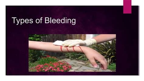 Types Of Bleeding Ppt Ppt