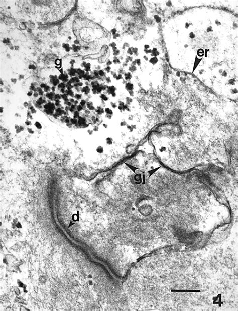 Electron Micrograph Of A Cell Aggregate Showing Gap Junctions Gj And