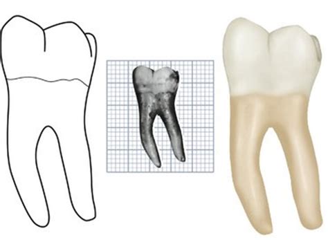 Permanent Mandibular First Molar