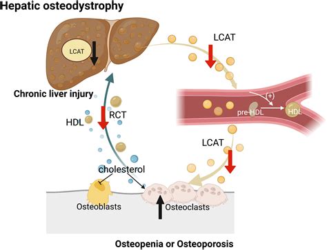 Frontiers Liver Bone Crosstalk In Non Alcoholic Fatty Liver Disease