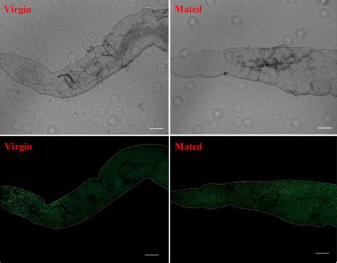 Mating Increases Neutral Lipid Content Revealed By Bodipy Staining In