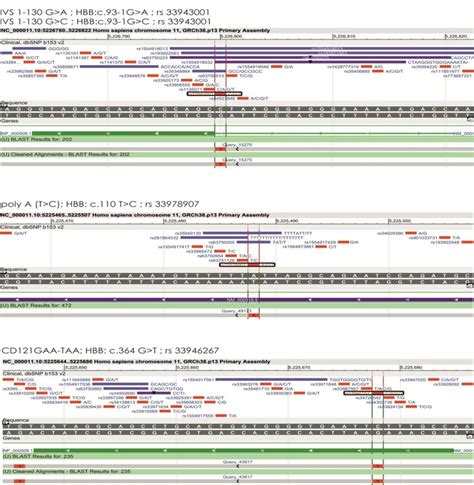 DNA sequence results of HBB Gene Mutation. | Download Scientific Diagram