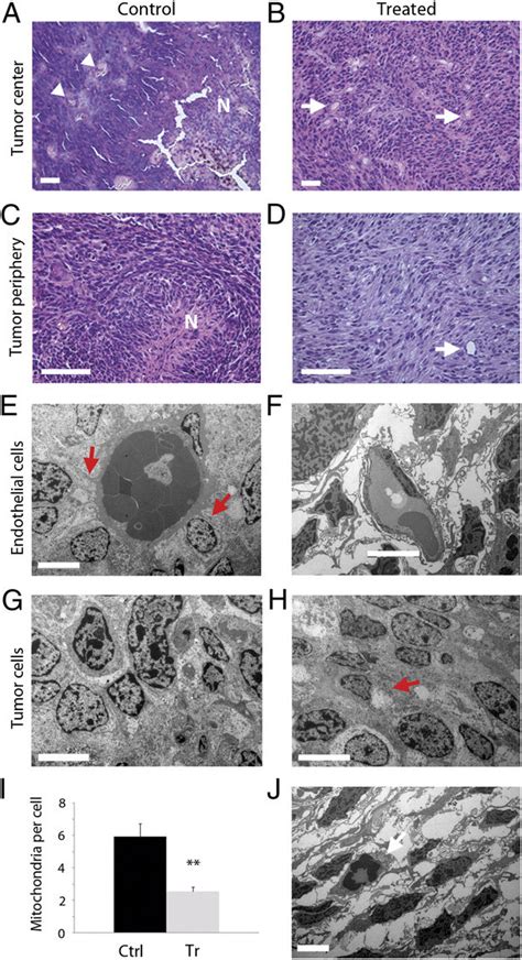 Histological And Ultrastructural Changes After Bev Treatment