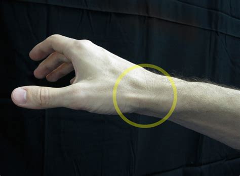 mommy thumb   recognize   signs