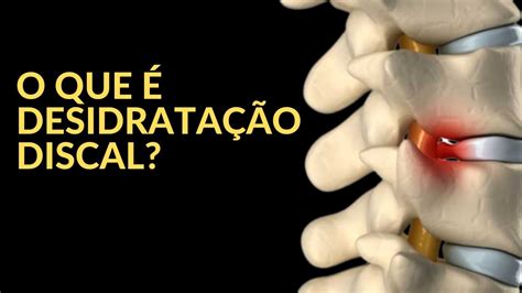 O que é Desidratação Discal YouTube