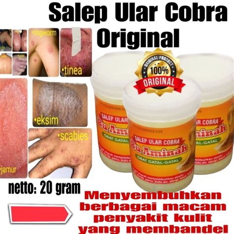 Jual Minyak Ular Cobra Asli Obat Gatal Kulit Berair Bernanah Shopee