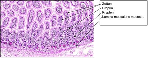 Ileum Mensch