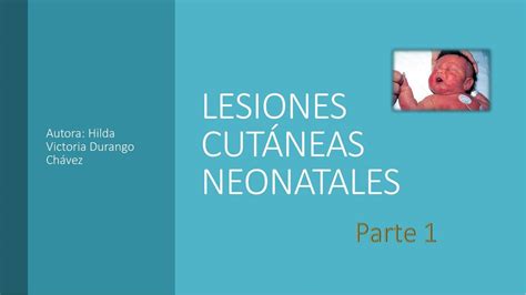 Lesiones Cutáneas Neonatales Análisis Clínico Medicine For All Udocz