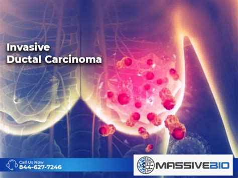 Invasive Ductal Carcinoma - What is Invasive Ductal Carcinoma?