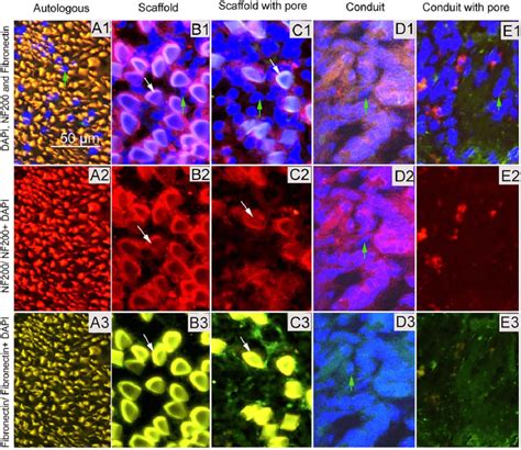 Immunofluorescence Of Nerve Graft Frozen Sections Stained With DAPI