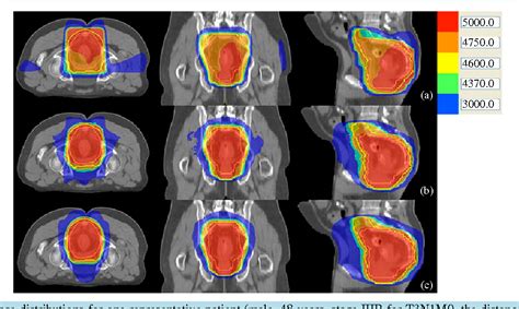 Figure From Dosimetric Comparison Of Volumetric Modulated Arc Therapy