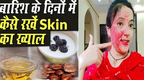 Monsoon Skin Care Tips How To Take Care Of Skin In Monsoon