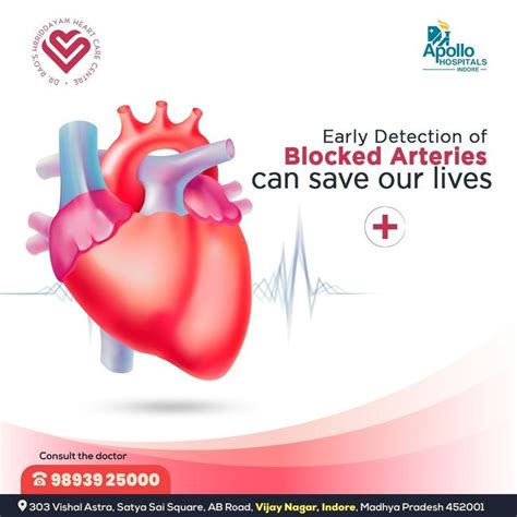 Best Cardiologist In Indore Cardiologist In Mp Dr Sarita Rao