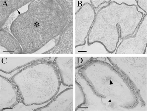 A Histological Cross Section Of Cauda Epididymis Of Control Rat