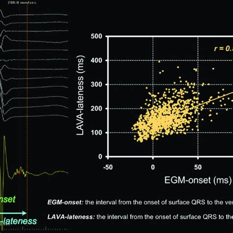 (A) ECG showing minimal preexcitation (rsR= pattern in lead III) only... | Download Scientific ...