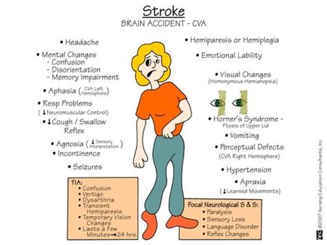 87 best Stroke & Mini Stroke (T.I.A.) images on Pinterest | Diff'rent ...