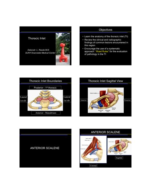 Thoracic Inlet Objectives Thoracic Inlet Boundaries Thoracic Inlet ...