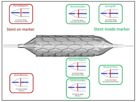 JCM Free Full Text Evolution Of Coronary Stent Platforms A Brief