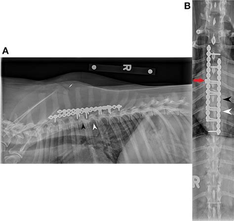 Frontiers Diagnostic Traction And Dorsal Locking Plate Stabilization