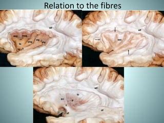 Insular lobe anatomy | PPT