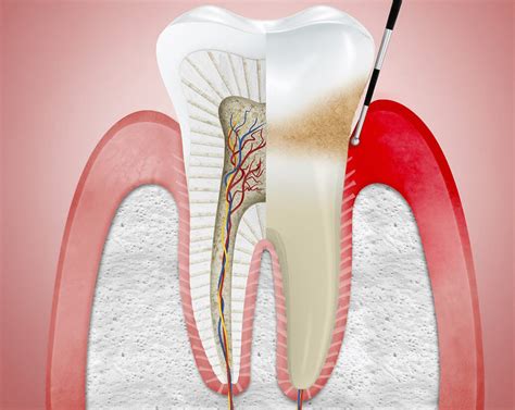 Periodoncia Centro Clinico Especialidades Dentales