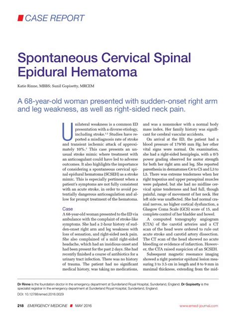 Pdf Spontaneous Cervical Spinal Epidural Hematoma Epidural Hematoma