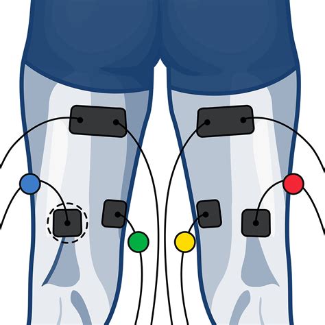 Electrode Placement For Muscle Stimulation Compex