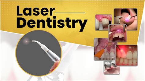 Laser Dental Clinic Near You Laser Dentist Near Me